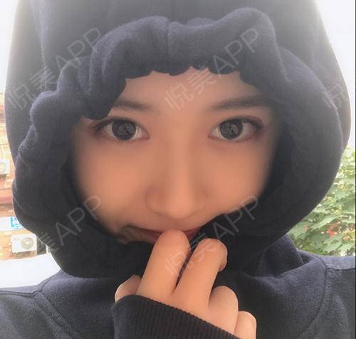 走在校园里的我,现在特别喜欢装嫩,因为漂亮的女孩子...眼综合整形悦美整形